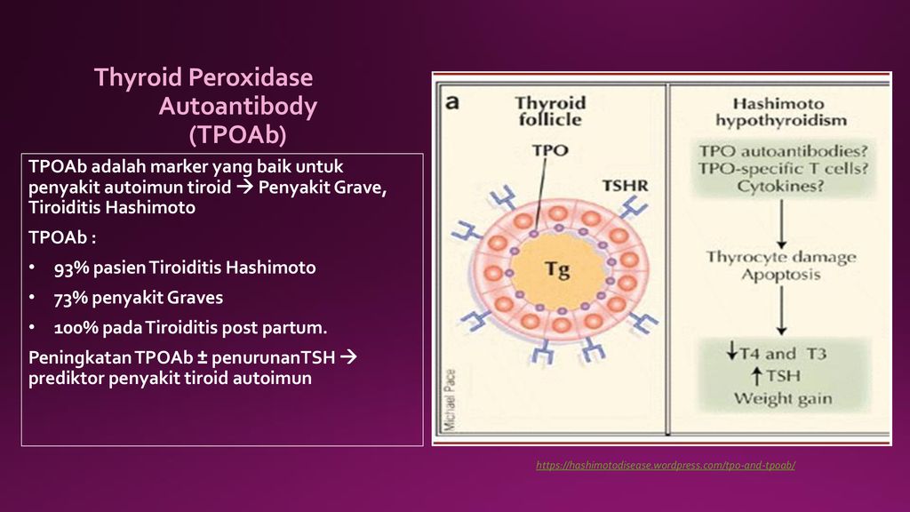 Que es tiroiditis de hashimoto
